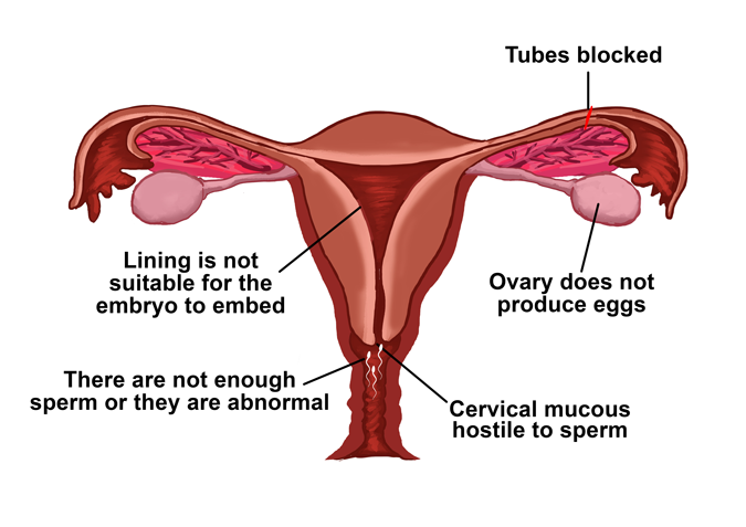 Fertility-img